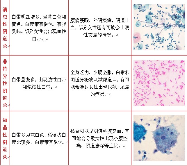 阴道炎种类