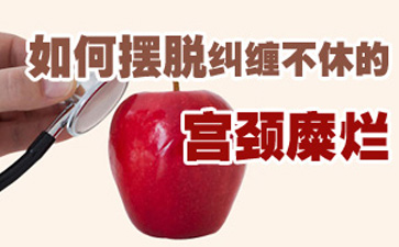 如何摆脱纠缠不休的宫颈糜烂